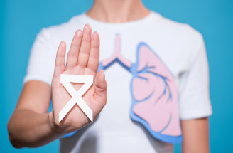 Rakovina pľúc – prejavy, diagnostika, liečba. Ako jej predchádzať?