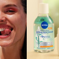 Pleťová rutina pre fotky bez filtrov: Objav novinky z radu Derma Skin Clear od NIVEA!